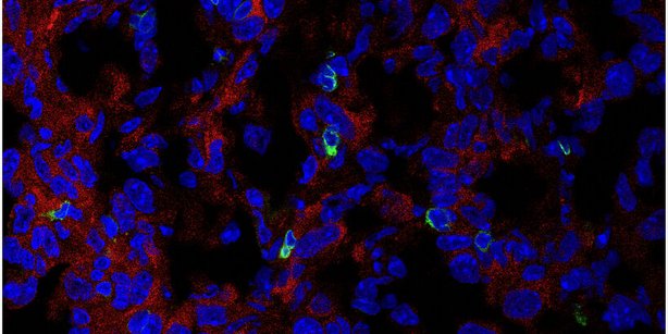 Immunfluoreszenzbild 
