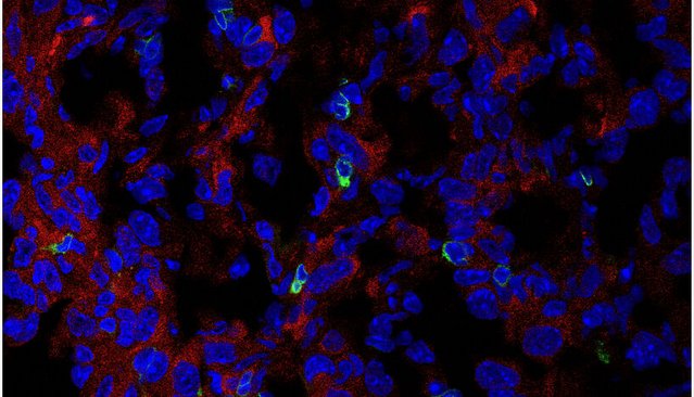 Immunfluoreszenzbild 