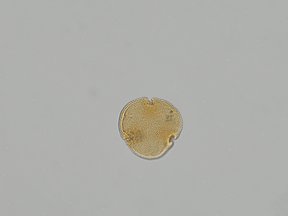 Picture of the light microscope image of pollen extracted from the fossilised flower.