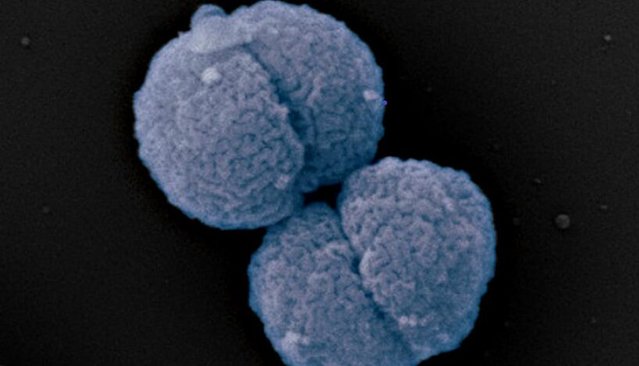 The bacteria Neisseria gonorrhoeae (gonococci)