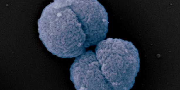 The bacteria Neisseria gonorrhoeae (gonococci)
