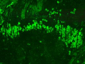 Picture of fluorescent fossil pollen on the body of the fossil bumble bee.