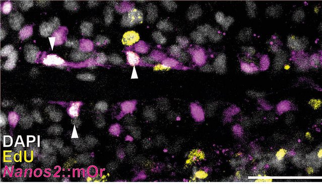 laser scanning confokale fluoreszenz-mikroskopische Aufnahme aus dem Körper der Seeanemone Nematostella vectensis.