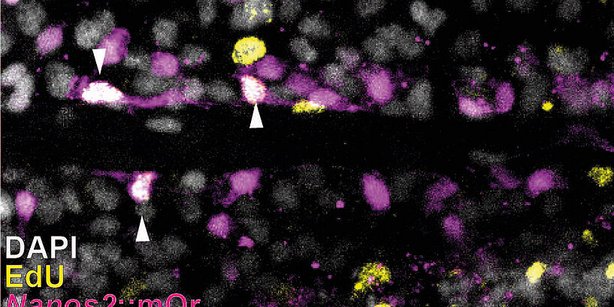 laser scanning confokale fluoreszenz-mikroskopische Aufnahme aus dem Körper der Seeanemone Nematostella vectensis.